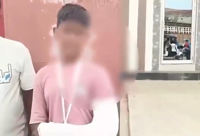 अछनेरा: धर्मपुरा कंपोजिट विद्यालय में कक्षा 7 के छात्र की डंडे से बेरहमी से पिटाई! हाथ में आया फ्रैक्चर, DCP वेस्ट से शिकायत के बाद दर्ज हुई FIR
